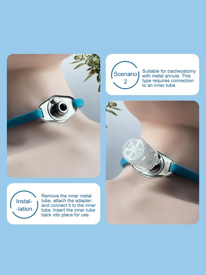 Tracheostomy Speaking Valve